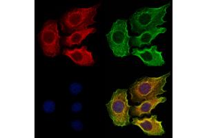 ABIN6265108 and ABIN6273319 staining Hela cells by IF/ICC.