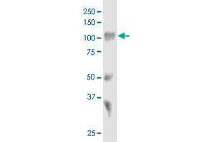 SORT1 monoclonal antibody (M01), clone 1B3.