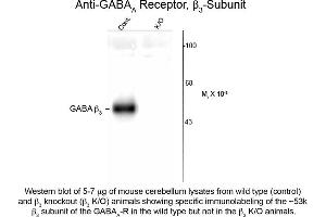 Western blot of GABAA Receptor ß3 Antibody Western Blot of Rabbit anti-GABAA Receptor ß3 Antibody.