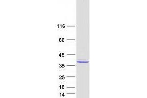 Validation with Western Blot
