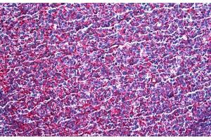 Human Tonsil: Formalin-Fixed, Paraffin-Embedded (FFPE)
