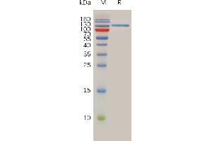 Human S Protein, hFc Tag on SDS-PAGE under reducing condition.