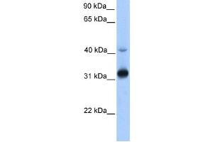 Western Blotting (WB) image for anti-Trans-2,3-Enoyl-CoA Reductase (TECR) antibody (ABIN2459195) (TECR anticorps)