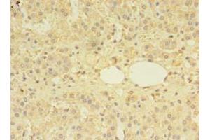 Immunohistochemistry of paraffin-embedded human adrenal gland tissue using ABIN7159585 at dilution of 1:100 (MTR anticorps  (AA 923-1265))
