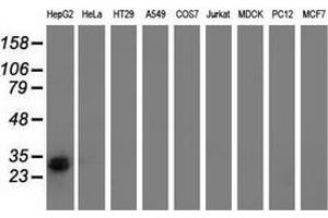 Western blot analysis of extracts (35 µg) from 9 different cell lines by using anti-RASD2 monoclonal antibody. (RASD2 anticorps)