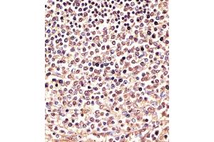 (ABIN6243739 and ABIN6577971) staining PSMB9 in human spleen sections by Immunohistochemistry (IHC-P - paraformaldehyde-fixed, paraffin-embedded sections).