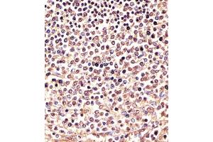 (ABIN6243739 and ABIN6577971) staining PSMB9 in human spleen sections by Immunohistochemistry (IHC-P - paraformaldehyde-fixed, paraffin-embedded sections). (PSMB9 anticorps  (C-Term))