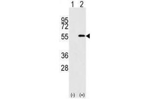 Image no. 1 for anti-Nucleoporin 50kDa (NUP50) (C-Term) antibody (ABIN357219) (NUP50 anticorps  (C-Term))