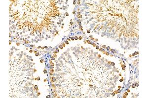 ABIN6256941 and ABIN6274588 at 1/100 staining Rat testis tissue by IHC-P.