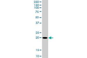 RHOC monoclonal antibody (M01), clone 2E12.