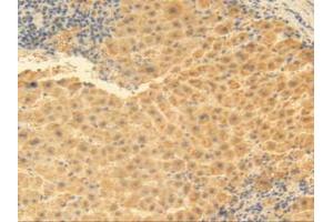IHC-P analysis of Human Liver Tissue, with DAB staining. (MGP anticorps  (AA 1-103))