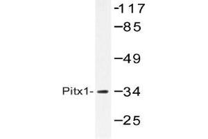 Western blot (WB) analysis of Pitx1 antibody in extracts from Jurkat cells. (PITX1 anticorps)