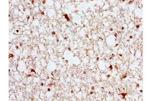 IHC image of ABIN7144757 diluted at 1:300 and staining in paraffin-embedded human brain tissue performed on a Leica BondTM system. (Aspartate beta Hydroxylase anticorps  (AA 75-270))