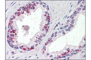 Human Prostate (formalin-fixed, paraffin-embedded) stained with ANXA1at 4 µg/ml followed by biotinylated anti-goat IgG secondary antibody, alkaline phosphatase-streptavidin and chromogen. (Annexin a1 anticorps  (C-Term))