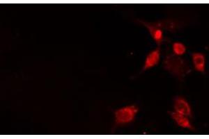 ABIN6272360 staining Hela by IF/ICC.