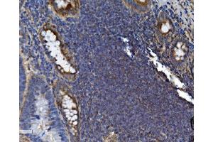 IHC analysis of SEC14L3/TAP2 using anti-SEC14L3/TAP2 antibody (ABIN7601623). (SEC14L3 anticorps  (AA 4-400))