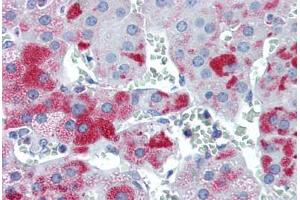 Human Adrenal (formalin-fixed, paraffin-embedded) stained with M6PRBP1 antibody ABIN351437 at 5 ug/ml followed by biotinylated goat anti-rabbit IgG secondary antibody ABIN481713, alkaline phosphatase-streptavidin and chromogen.