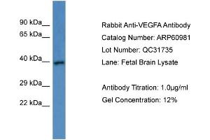 Western Blotting (WB) image for anti-Vascular Endothelial Growth Factor A (VEGFA) (C-Term) antibody (ABIN2788641) (VEGFA anticorps  (C-Term))