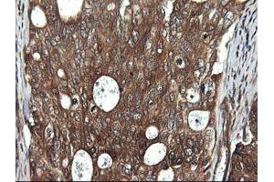 anti-DEAD (Asp-Glu-Ala-Asp) Box Polypeptide 58 (DDX58) antibody