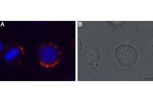 Expression of MC4R in rat pituitary cell line - Cell surface detection of MC4R in live intact GH3 cells with Anti-MC4 Receptor (extracellular) Antibody (ABIN7043324, ABIN7044596 and ABIN7044597), (1:50). (MC4R anticorps  (Extracellular, N-Term))