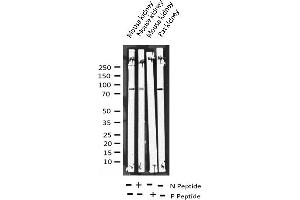 Western blot analysis of Phospho-Tau (Ser422) expression in various lysates