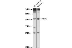 Western blot analysis of extracts of various cell lines, using AREG antibody (ABIN6127431, ABIN6137065, ABIN6137066 and ABIN6216408) at 1:1000 dilution.