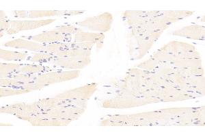 Detection of TAZ in Mouse Skeletal muscle Tissue using Polyclonal Antibody to Tafazzin (TAZ) (TAZ anticorps  (AA 46-240))