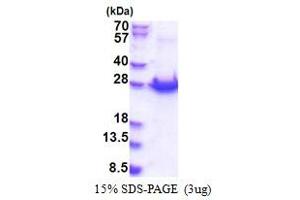 SDS-PAGE (SDS) image for Protein-L-Isoaspartate (D-Aspartate) O-Methyltransferase Domain Containing 1 (PCMTD1) (AA 1-220) protein (His tag) (ABIN5853433)