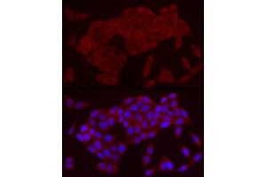 Immunofluorescence analysis of HeLa cells using IL21 Rabbit pAb (ABIN6128086, ABIN6142359, ABIN6142360 and ABIN6223071) at dilution of 1:50 (40x lens). (IL-21 anticorps  (AA 25-162))