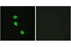 Immunofluorescence analysis of HeLa cells, using AS160 (Phospho-Thr642) Antibody. (TBC1D4 anticorps  (pThr642))