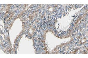 ABIN6276352 at 1/100 staining Human prostate tissue by IHC-P.