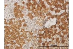 Immunoperoxidase of monoclonal antibody to FOXO1A on formalin-fixed paraffin-embedded human liver.