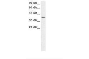 Image no. 1 for anti-Ribosomal Protein S16 (RPS16) (AA 92-139) antibody (ABIN202390) (RPS16 anticorps  (AA 92-139))