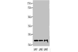 Western blot All lanes: MRPS18A antibody at 6 μg/mL Lane 1: HL60 whole cell lysate Lane 2: A549 whole cell lysate Lane 3: HepG2 whole cell lysate Secondary Goat polyclonal to rabbit IgG at 1/10000 dilution Predicted band size: 23, 31, 15 kDa Observed band size: 23 kDa (MRPS18A anticorps  (AA 1-196))