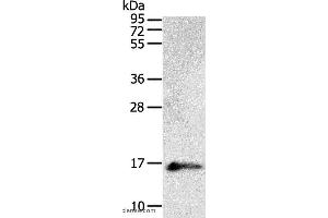 Western blot analysis of Human fetal brain tissue, using PVALB Polyclonal Antibody at dilution of 1:400 (PVALB anticorps)