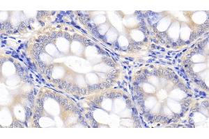 Detection of IL10 in Canine Colon Tissue using Polyclonal Antibody to Interleukin 10 (IL10) (IL-10 anticorps  (AA 21-181))