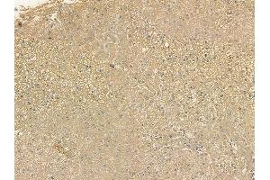 ABIN6256326 and ABIN6267207 at 1/100 staining human normal liver tissue by IHC-P. (WIPI2 anticorps  (pSer413))