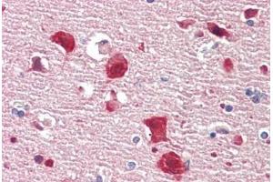 Human Brain, Cortex: Formalin-Fixed, Paraffin-Embedded (FFPE)