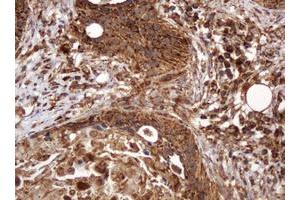 Image no. 11 for anti-B and T Lymphocyte Associated (BTLA) antibody (ABIN1496983) (BTLA anticorps)