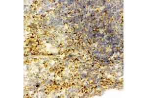 Anti-Caspase-6(P18) antibody, IHC(F): Rat Spleen Tissue