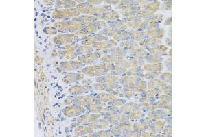 Immunohistochemistry of paraffin-embedded mouse stomach using EFHC1 antibody (ABIN5975244) at dilution of 1/100 (40x lens). (EFHC1 anticorps)