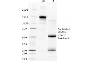 SDS-PAGE Analysis Purified CD28 Mouse Monoclonal Antibody (C28/77). (CD28 anticorps)