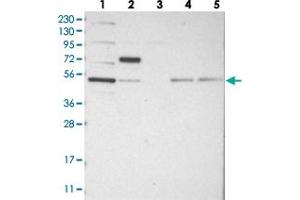 Western blot analysis of Lane 1: RT-4, Lane 2: U-251 MG, Lane 3: Human Plasma, Lane 4: Liver, Lane 5: Tonsil with CDCA7L polyclonal antibody  at 1:250-1:500 dilution. (CDCA7L anticorps)