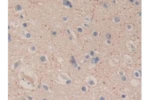 Detection of CPB1 in Human Cerebrum Tissue using Polyclonal Antibody to Carboxypeptidase B1, Tissue (CPB1) (CPB1 anticorps  (AA 111-417))