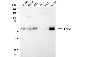 Western blotting analysis using HERPUD1 antibody (ABIN7798998).