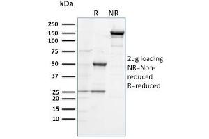 SDS-PAGE Analysis Purified CD284 Mouse Monoclonal Antibody (TLR4/230). (TLR4 anticorps)