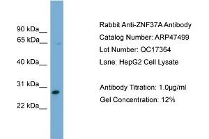 WB Suggested Anti-ZNF37A  Antibody Titration: 0. (ZNF37A anticorps  (Middle Region))