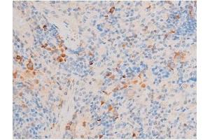 anti-Forkhead Box O4 (FOXO4) (pSer197) antibody