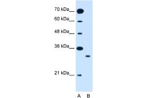 WB Suggested Anti-SLC25A22 Antibody Titration:  1.