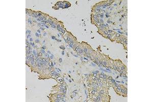 Immunohistochemistry of paraffin-embedded human prostate using AZGP1 Antibody (ABIN1876553) at dilution of 1:100 (40x lens). (AZGP1 anticorps)